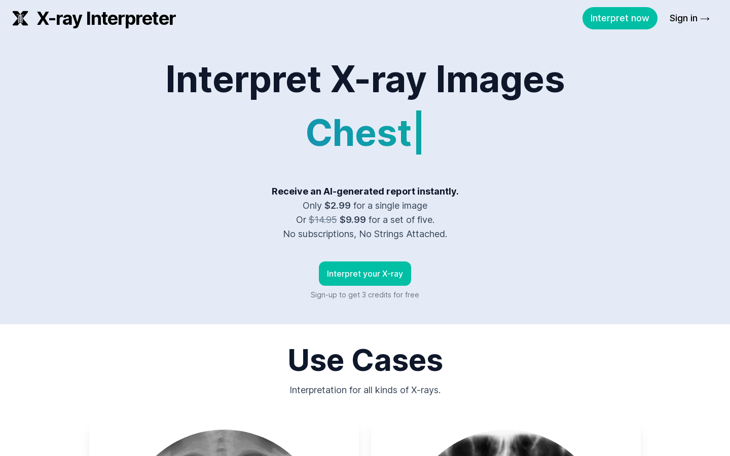 X Ray Interpret