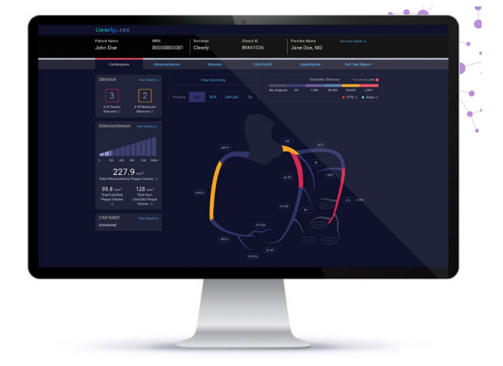 Cleerly筹集1.06亿美元资金 推动AI心脏筛查突破常规诊断